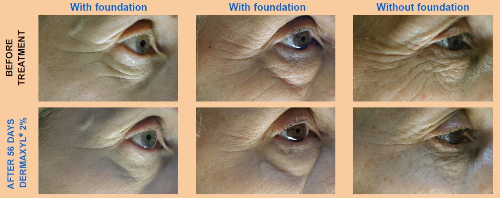 Dermaxyl Before and after results